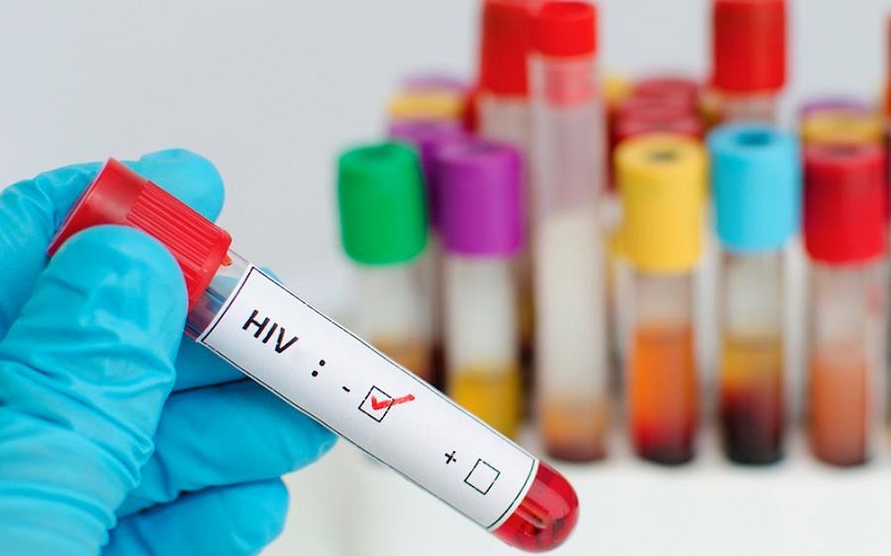 Những ai nên xét nghiệm HIV?
