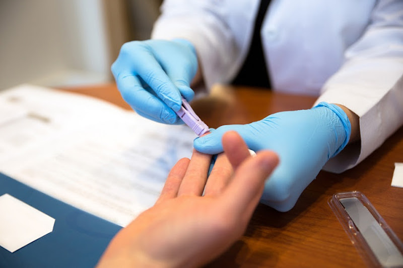 Chi phí xét nghiệm test nhanh HIV là bao nhiêu?