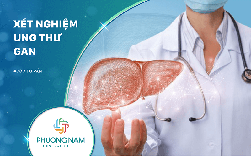 Xét Nghiệm Ung Thư Gan | Bảo Vệ “Bộ Lọc” Của Bạn