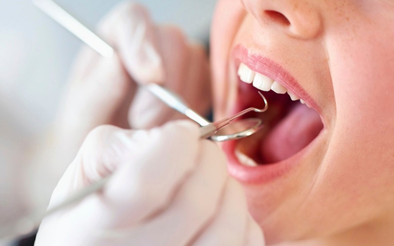 Quy trình lấy cao răng bạn nên biết