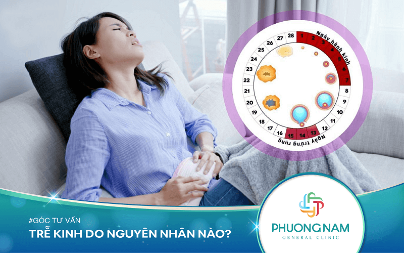 12 Nguyên Nhân Gây Trễ Kinh Nữ Giới Cần Biết
