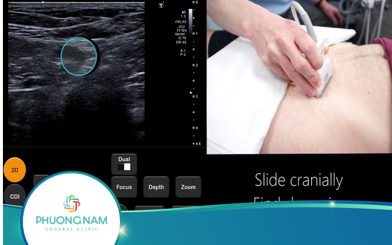 Địa chỉ Siêu Âm Viêm Ruột Thừa Uy Tín Và Chất Lượng
