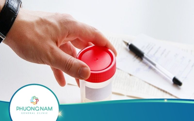 Xét Nghiệm Tinh Trùng Đánh Giá Khả Năng sinh Sản Ở Nam Giới