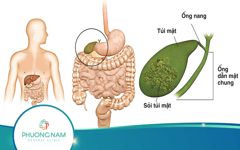 Địa Chỉ Siêu Âm Sỏi Mật Được Nhiều Khách Hàng Tin Tưởng