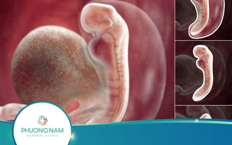 Thai 5 Tuần Siêu Âm Được Chưa? Và Cho Biết Điều Gì?