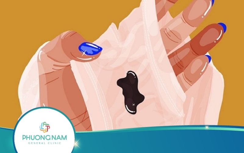 Tại Sao Kinh Nguyệt Có Màu Đen? 8 Nguyên Nhân Gây Ra