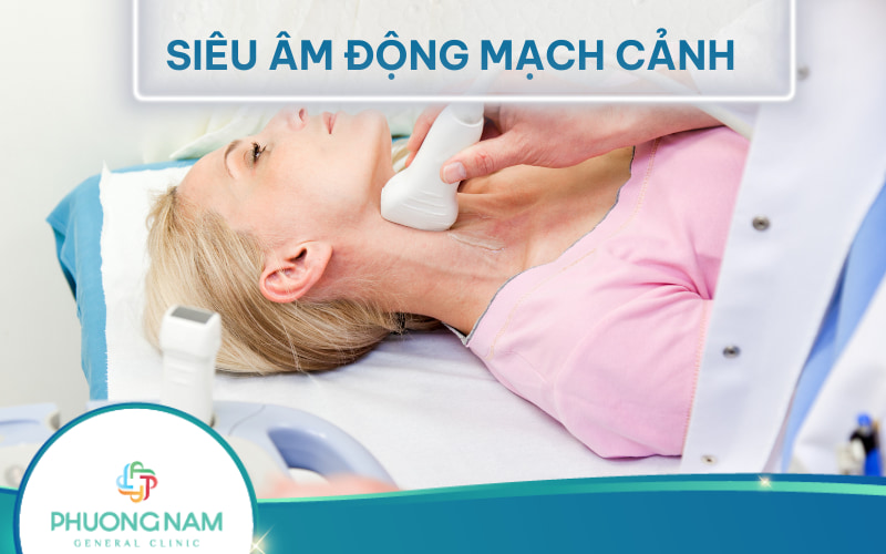Siêu âm động mạch cảnh (Doppler mạch cảnh) phát hiện bệnh lý gì?