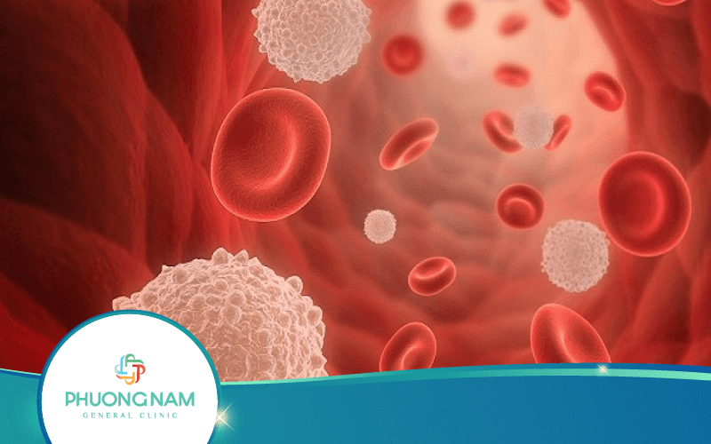 Xét Nghiệm Máu WBC Là Gì? – Ý Nghĩa Các Chỉ Số Bạch Cầu Trong Máu
