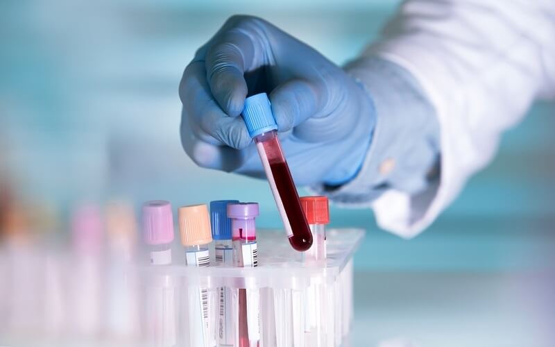Xét nghiệm ADN với mẫu máu
