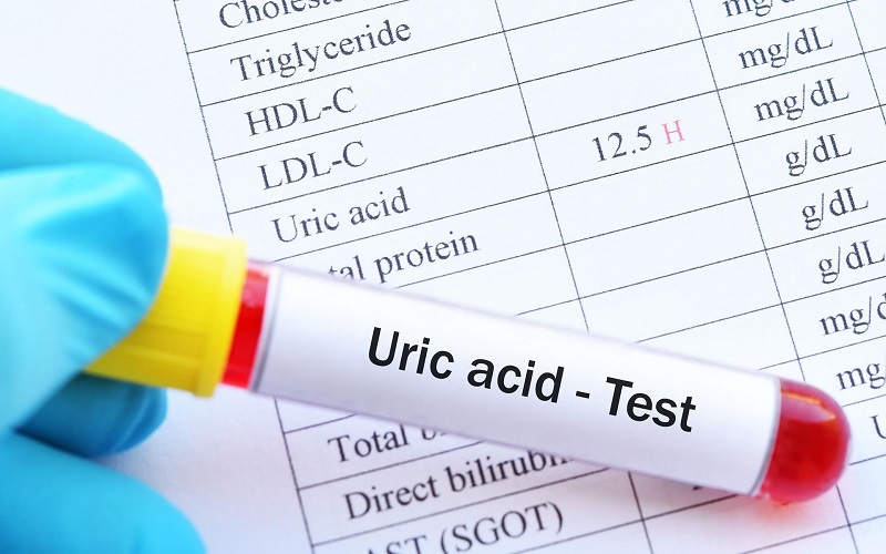 Xét nghiệm máu acid uric là gì