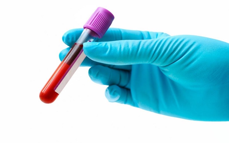 Xét nghiệm máu MCV bao nhiêu tiền?