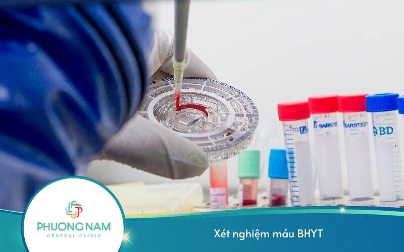 Xét Nghiệm Máu Có Được Hưởng Bảo Hiểm Y Tế Không?