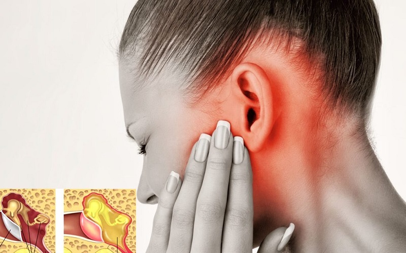 Dấu hiệu của bệnh viêm tai không phải ai cũng biết