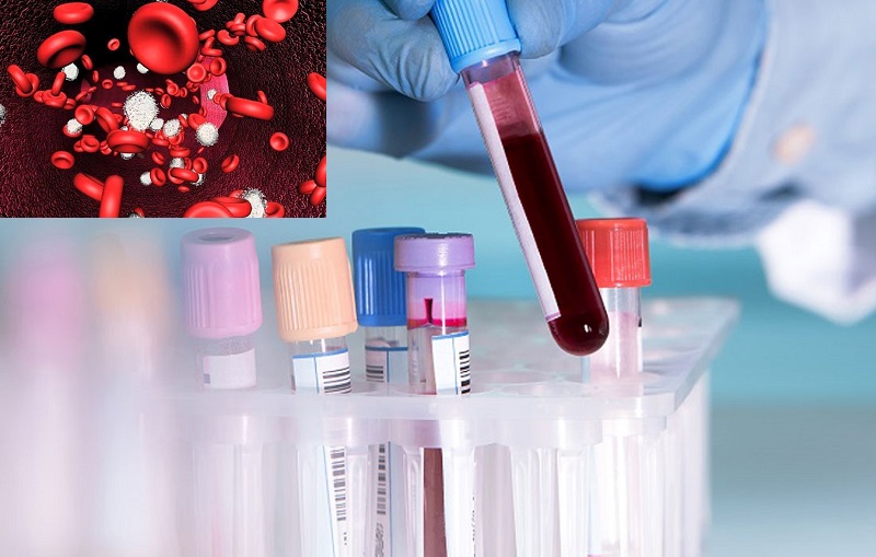 Xét nghiệm máu bạch cầu cao có nguy hiểm không?