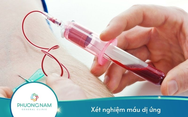 Xét Nghiệm Máu Dị Ứng – Tìm Nguyên Nhân Gây Dị Ứng Nhanh Chóng