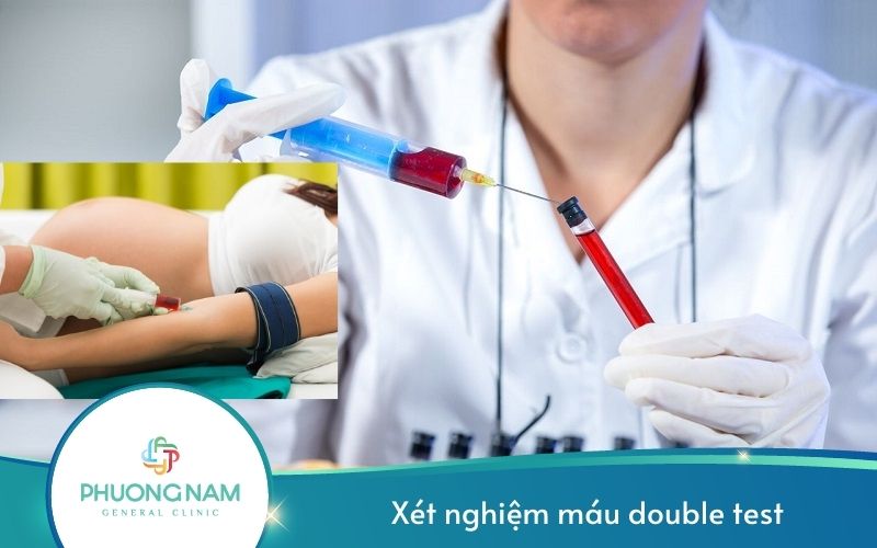 Xét Nghiệm Máu Double Test – Tầm Soát Dị Tật Thai Nhi Khi Mang Thai