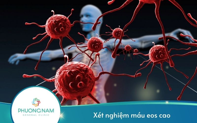Xét Nghiệm Máu Eos Cao Thì Có Nguy Hiểm Không?