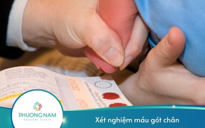 Xét Nghiệm Máu Gót Chân Trẻ Sơ Sinh – Những Điều Nên Biết