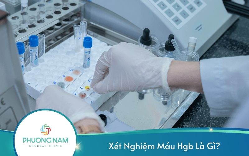 Xét Nghiệm Máu Hgb Là Gì?