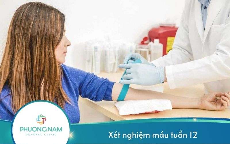 Xét Nghiệm Máu Tuần 12 Có Ý Nghĩa Gì? Các Xét Nghiệm Phải Tiến Hành