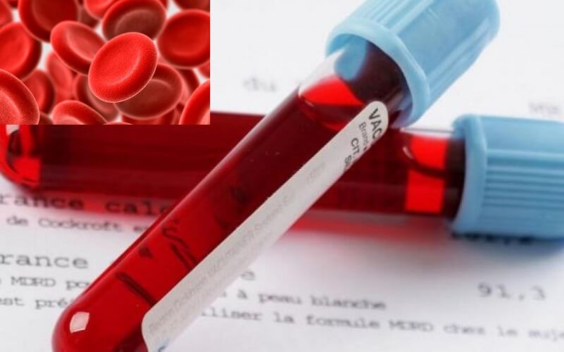 cách xem phiếu xét nghiệm máu