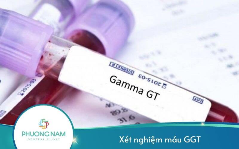 Chỉ Số GGT Trong Xét Nghiệm Máu Là Gì?
