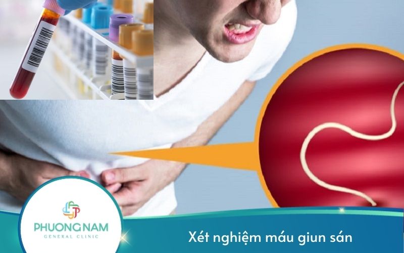Xét Nghiệm Máu Giun Sán – Tìm Ra Các Loại Ký Sinh Trung Trên Cơ Thể