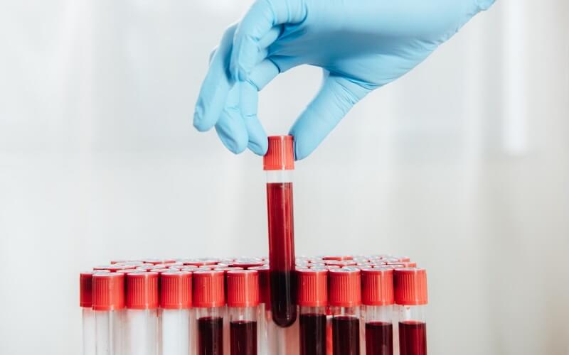 Chỉ số xét nghiệm máu hct bao nhiêu là bình thường?