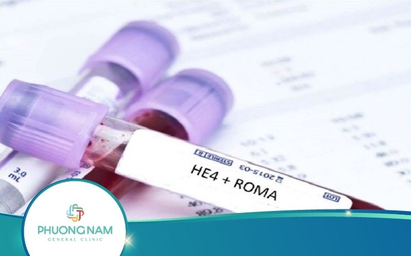 Xét Nghiệm Máu He4 – Phát Hiện Ung Thư Buồng Trứng Từ Giai Đoạn Sớm