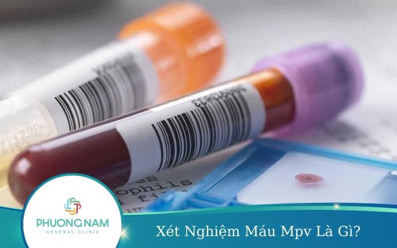 Xét Nghiệm Máu Mpv Là Gì? Ý Nghĩa Của Chỉ Số Mpv