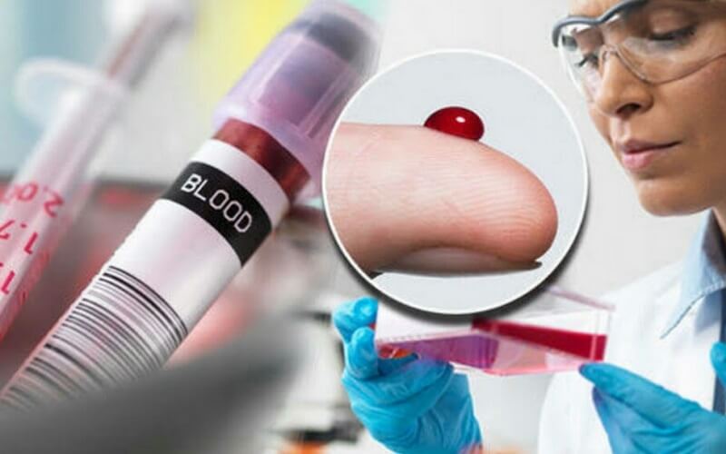 Ý nghĩa của các chỉ số xét nghiệm máu mpv là gì?
