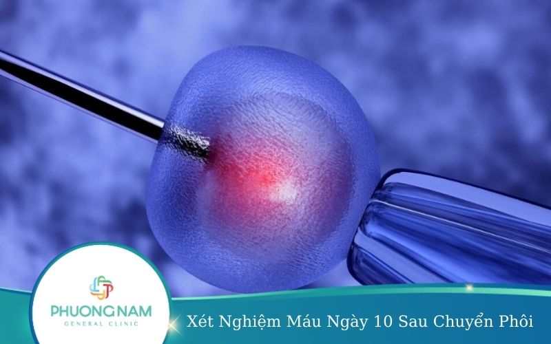Xét Nghiệm Máu Ngày 10 Sau Chuyển Phôi Để Làm Gì?