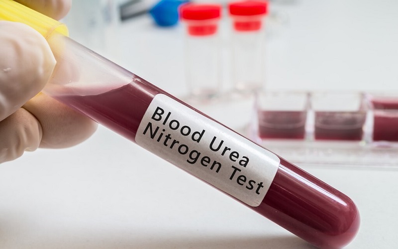 Xét nghiệm máu ure là gì?