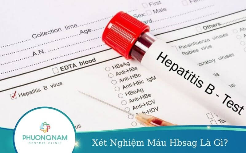 Xét Nghiệm Máu Hbsag Là Gì? Xét nghiệm Hbsag Dương Tính Có Ý Nghĩa Gì?