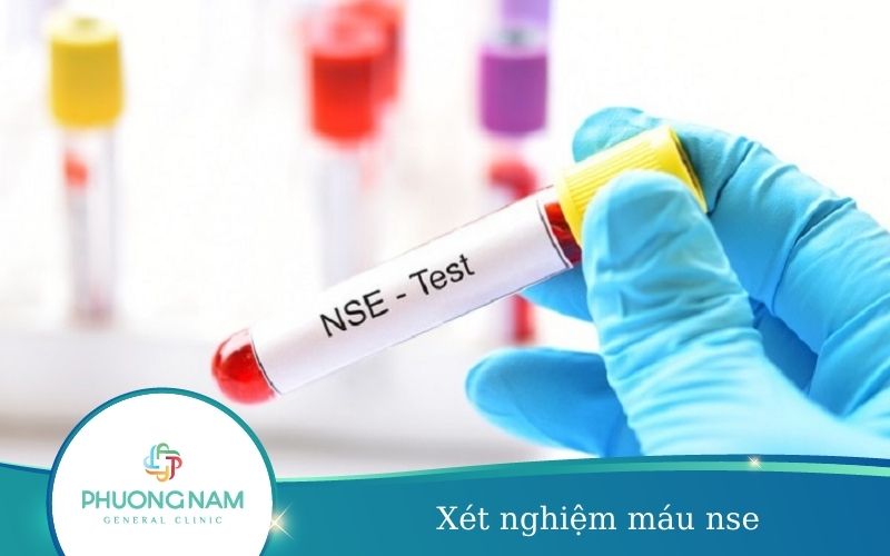 Xét Nghiệm Máu Nse – Những Điều Cần Lưu Ý