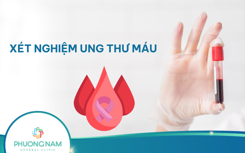 Các xét nghiệm ung thư máu thường được chỉ định