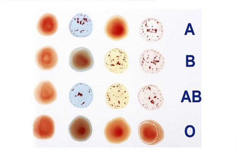 xet-nghiem-nhom-mau-o-dau