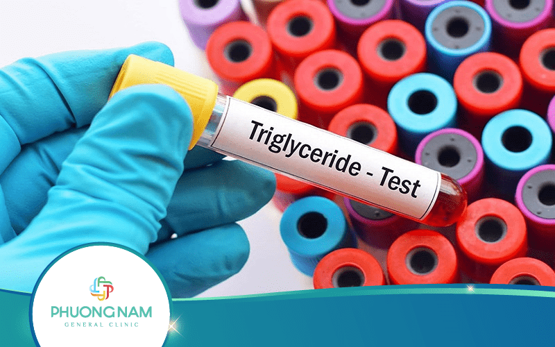 Chỉ Số Triglycerid Trong Xét Nghiệm Máu Là Gì?
