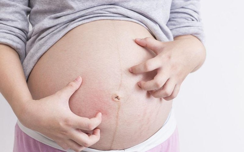 Cách xử lý tình trạng ngứa khi mang thai