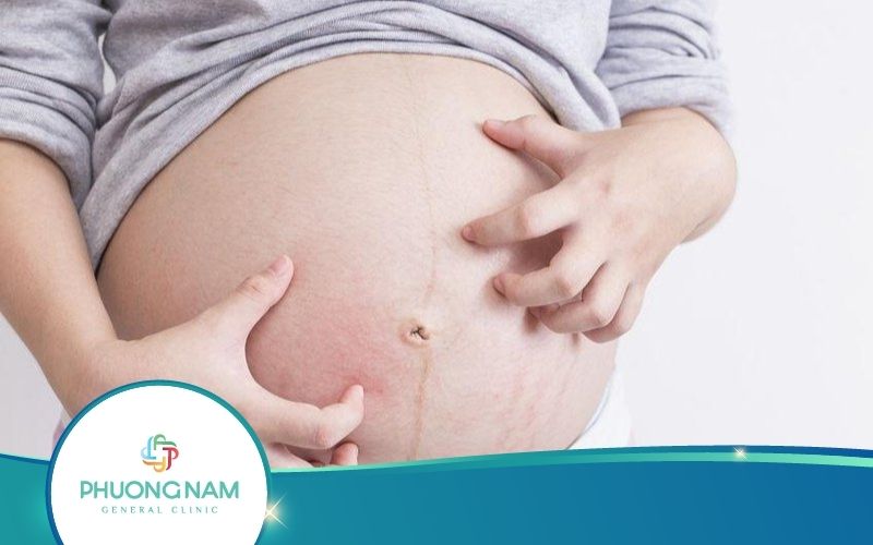 [Tip Hay] Bị Ngứa Khi Mang Thai – Nguyên Nhân Và Cách Xử Lý