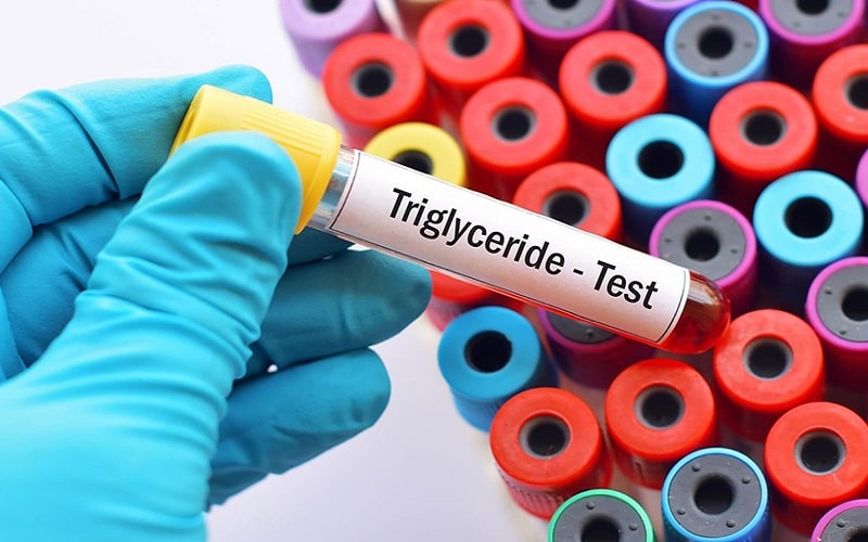 chi-so-triglycerid-trong-xet-nghiem-mau-la-gi