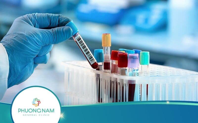 Xét Nghiệm Máu Có Phát Hiện Bệnh Lậu Không?