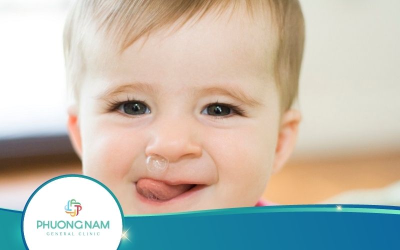 Top 5 Cách Trị Sổ Mũi Cho Bé Hiệu Quả Ngay Tại Nhà