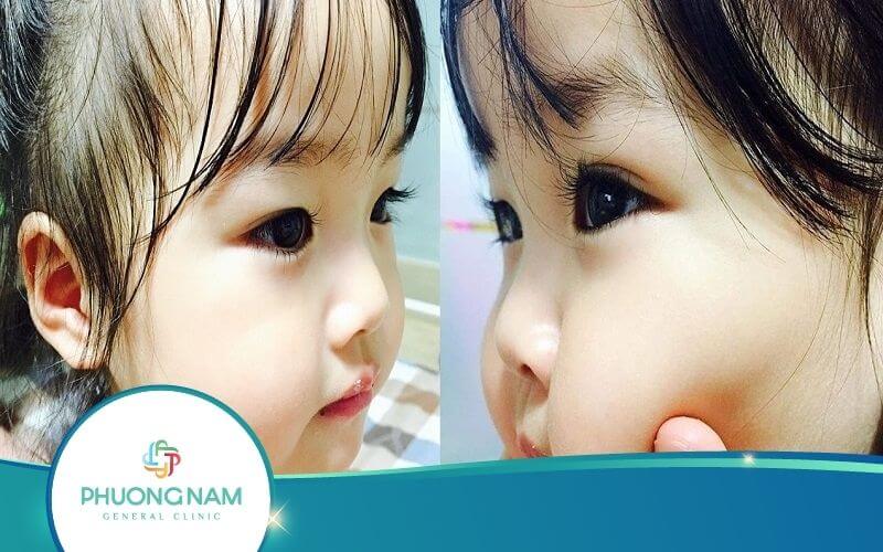 Làm Thế Nào Để Lông Mi Bé Dài Và Cong Siêu Đẹp?