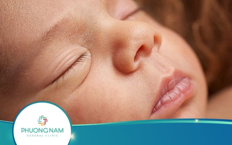 [Giải Đáp] Môi Trẻ Sơ Sinh Bị Rộp Trắng Phải Làm Sao?