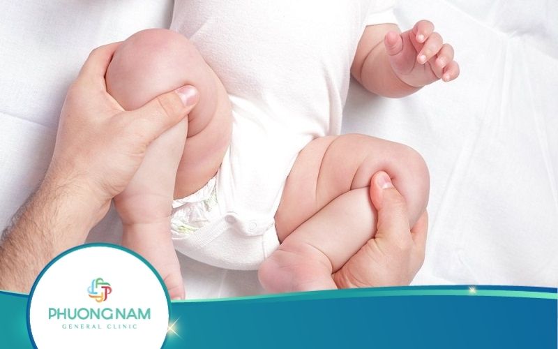 Có Nên Nắn Chân Cho Trẻ Sơ Sinh Không? – Bí Quyết Để Có Đôi Chân Đẹp