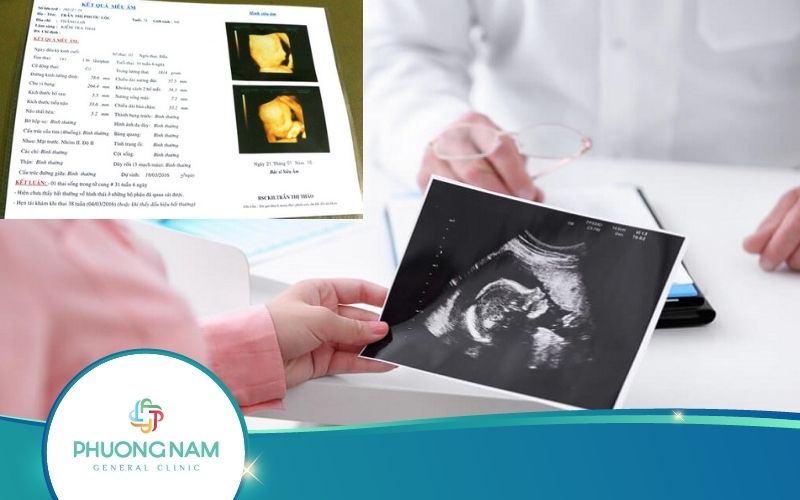 Chỉ Số Siêu Âm Thai 31 Tuần Mẹ Bầu Nhất Định Phải Biết