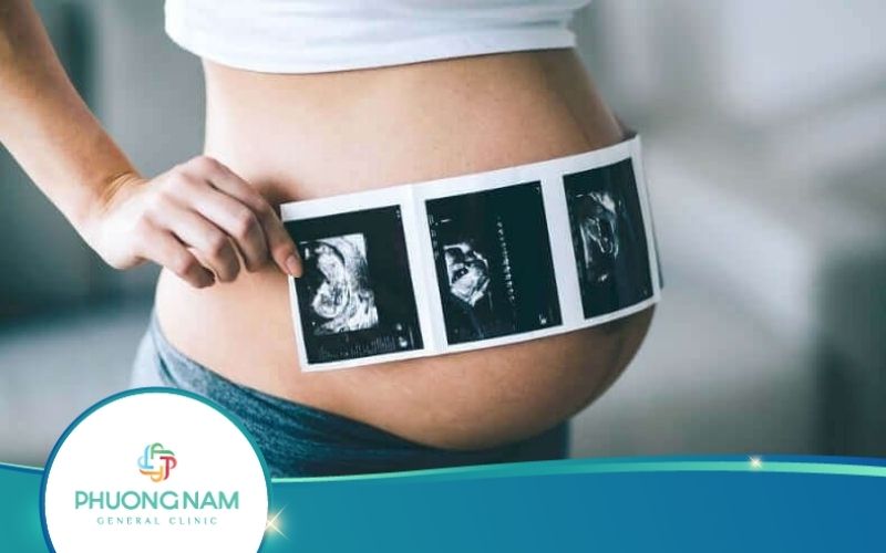 Crl Trong Siêu Âm Thai Là Gì? Ý Nghĩa Của Ctrl Trong Siêu Âm
