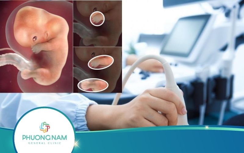 Siêu Âm Thai 9 Tuần Tuổi – Những Điều Mẹ Nên Biết