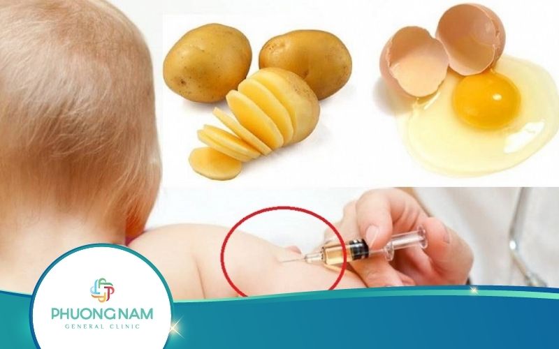 Có Nên Đắp Khoai Tây Vào Chỗ Tiêm Không? Cách Đắp Khoai Tây Giảm Sưng Hiệu Quả